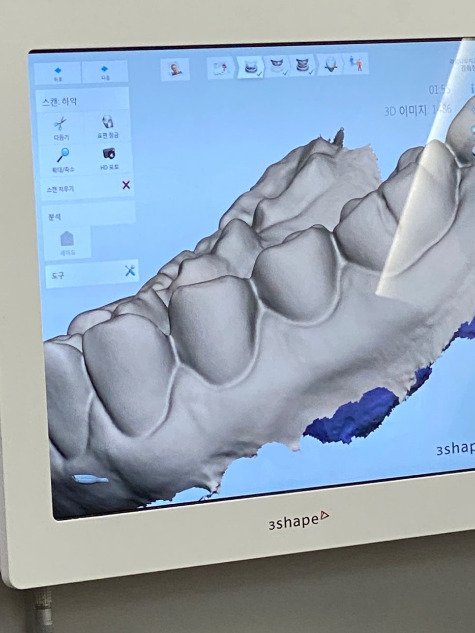 라임나무치과 직원들의 구강스캔대회 후기 관련 이미지 3