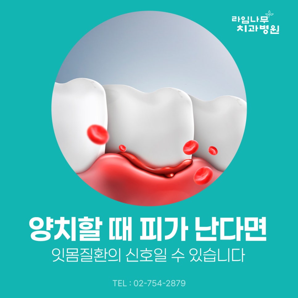 Myeongdong Dental Clinic: Bleeding When Brushing May Be a Sign of Gum Disease image 2