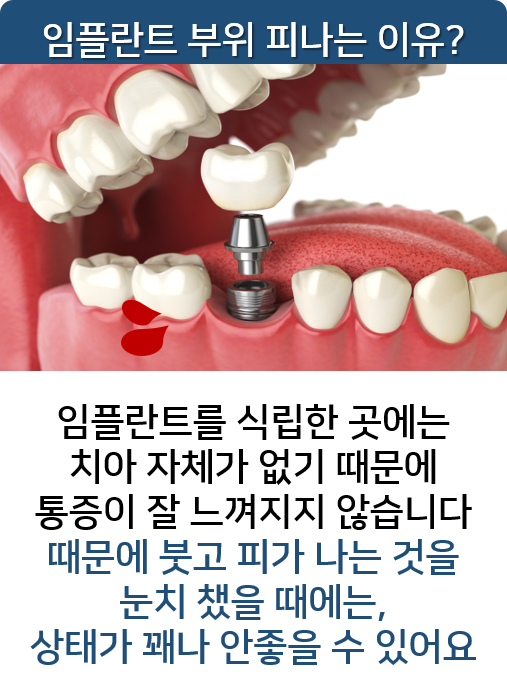 임플란트 부위 피날때, 문제점 알아봐요! 명동치과 라임나무 관련 이미지 2