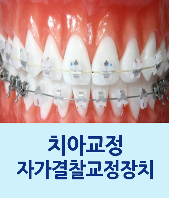 잠깐만요! 자가결찰교정장치 알고 가실께요~ 관련 이미지 1