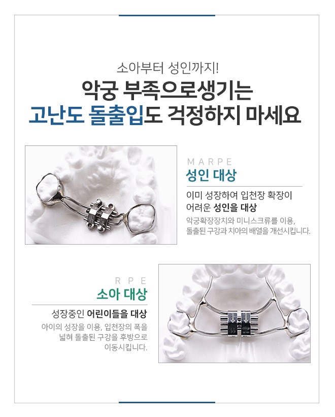 명동치과에서 비발치교정 시작해 보세요 관련 이미지 5