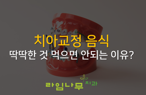 치아교정 음식 딱딱한 것 먹으면 안되는 이유? 명동치과 라임나무 관련 이미지 1