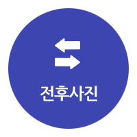 하루 만에 완성하는 임플란트, 만성질환이 있어도 OK 관련 이미지 19