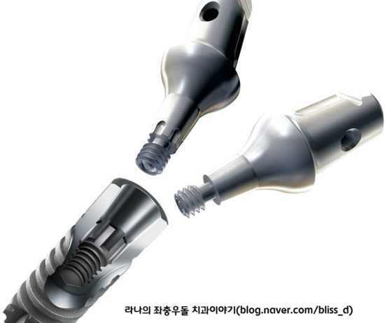 명동임플란트 심미성? 기능성? 어떤 비중을 둬야할까? 관련 이미지 2