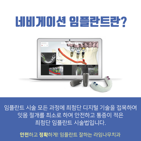 통증은 적고 시술은 빠른 라임나무치과 "네비게이션원리임플란트" 관련 이미지 1