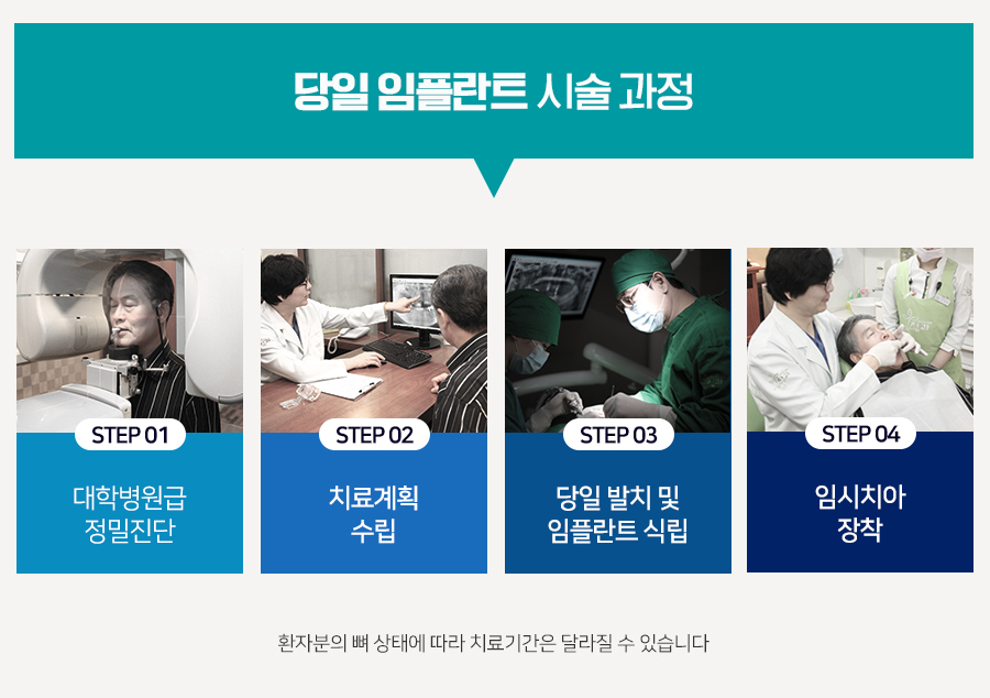 치료기간 걱정 덜어주는 당일임플란트 관련 이미지 3