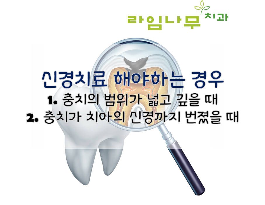 신경치료 해야되는 경우? 명동역치과와 증상 알아봐요 관련 이미지 3