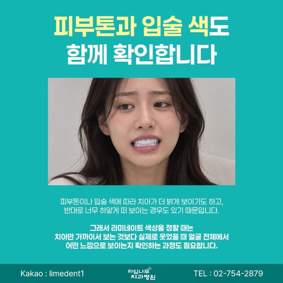명동 라미네이트 라미네이트, 무조건 하얗게 하면 좋을까요? 자연스러운 색상을 고르는 기준 관련 이미지 4