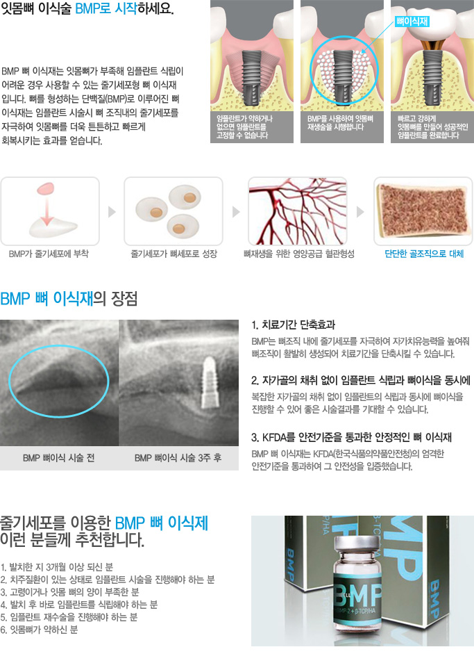 [명동치과 라임나무]오스템 임플란트 시술, 라임나무와 함께하세요 관련 이미지 9