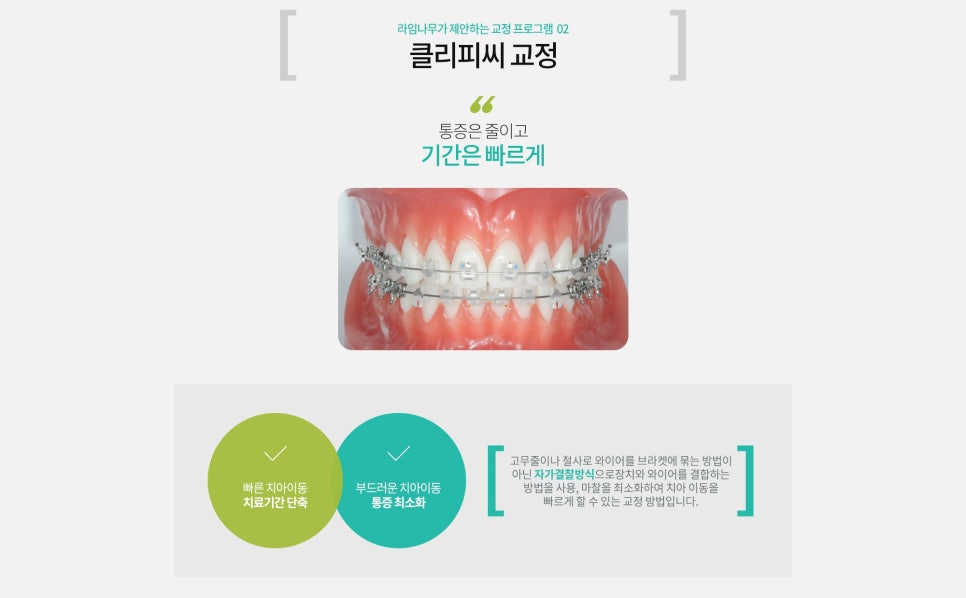 명동치과 클리피씨 교정 궁금하다면? 라임나무치과 관련 이미지 2