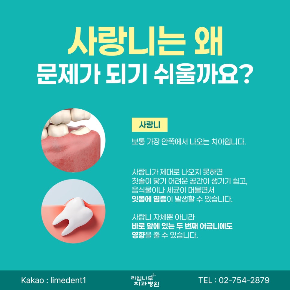 명동 치과 사랑니는 무조건 빼야 할까요? 발치가 필요한 경우 알아보기 관련 이미지 3