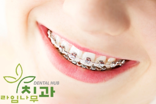 [명동치과] 치아교정 기간? 통증? 교정 궁금증 라임나무치과와 알아보기 관련 이미지 5