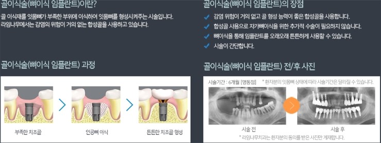 라임나무치과의 임플란트 솔루션을 소개합니다. 관련 이미지 5