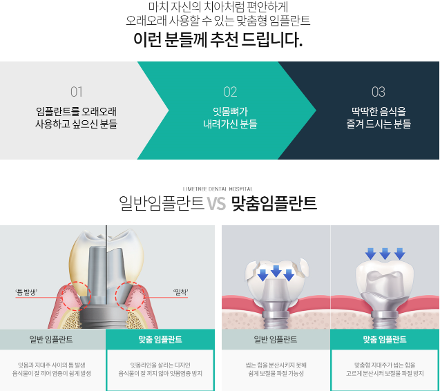 임플란트 기간 얼마나 걸릴까? 임플란트 뼈이식, 임플란트 종류 관련 이미지 12