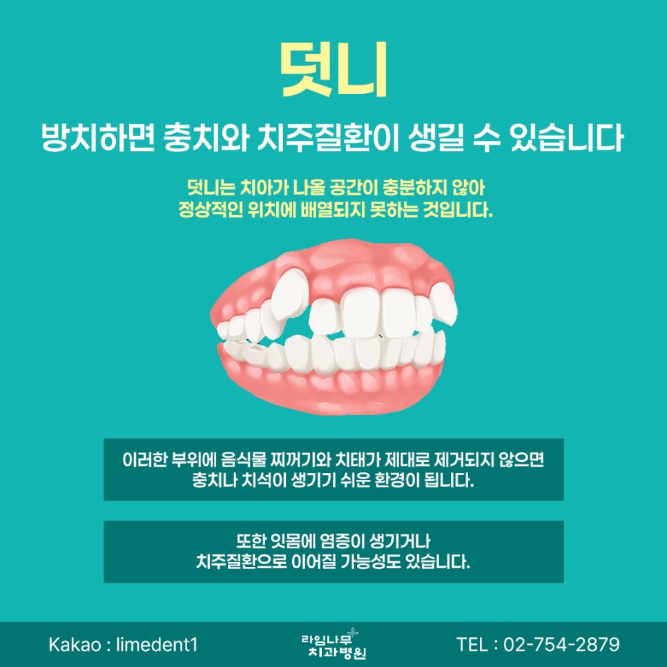 치아교정 시작 전, 알아둬야 할 체크포인트 관련 이미지 4