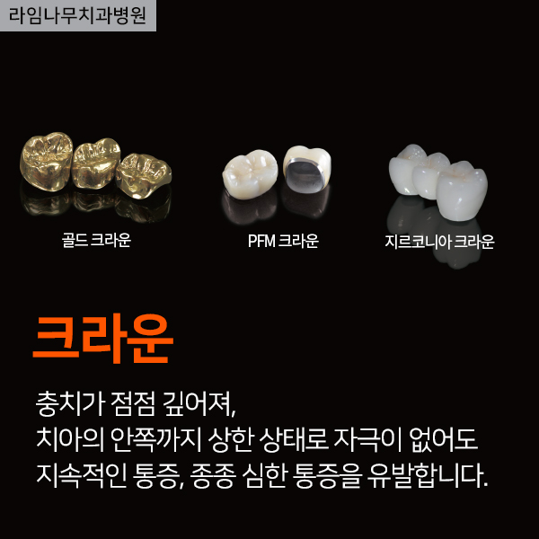 보철치료종류(레진,인레인,크라운) 유지관리방법 관련 이미지 4