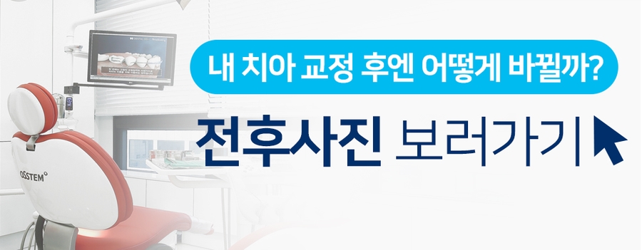 [주걱턱 무턱 돌출입] 치아교정의 선택기준 관련 이미지 10