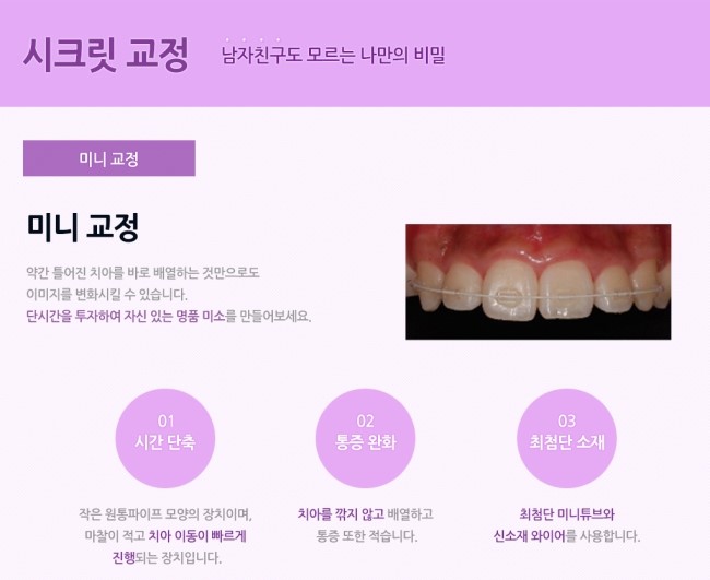 치아교정 종류와 비용 알아보기 관련 이미지 12