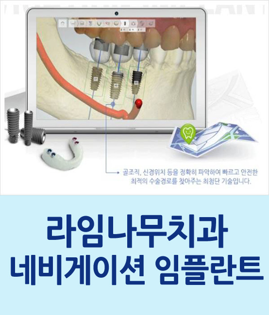 라임나무치과의 네비게이션 임플란트를 소개합니다 관련 이미지 1