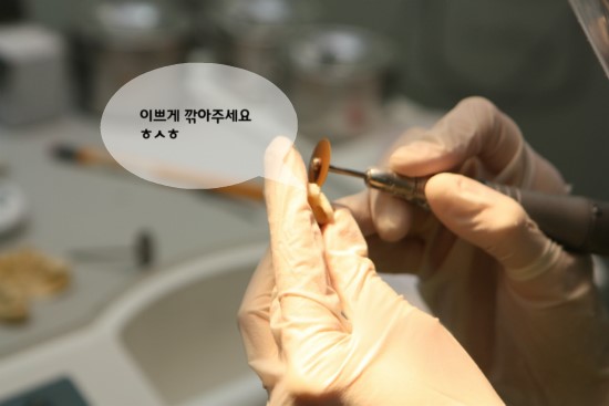 임시치아 제작 테스트 in 라임나무치과병원 관련 이미지 6