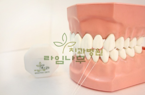 치실 사용시 피가 나는 이유는? 관련 이미지 2