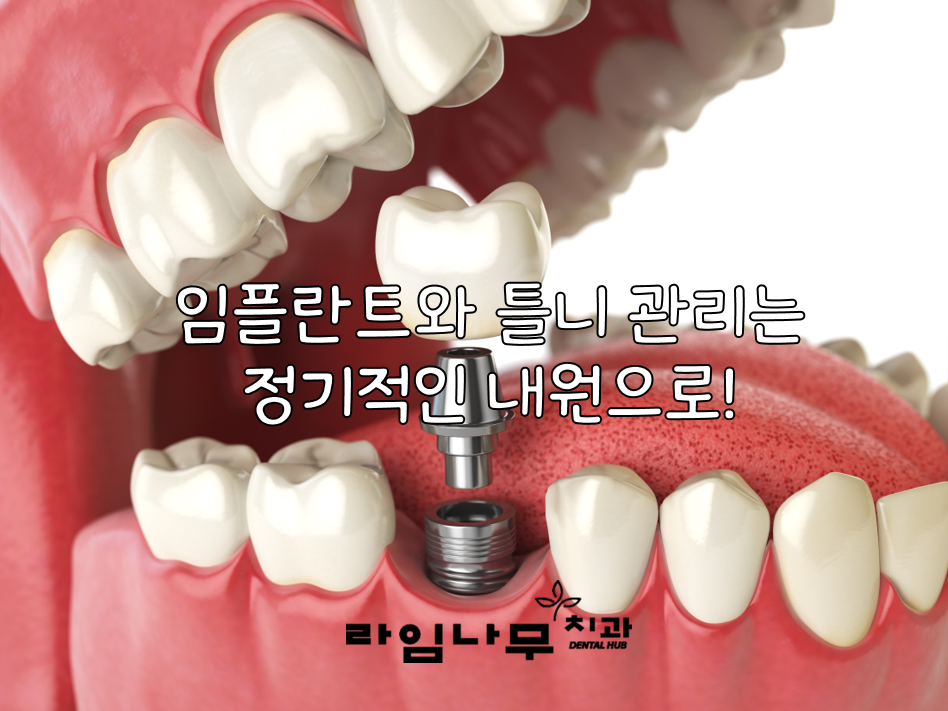 노년 시기 노인 틀니, 임플란트 와 치아관리법 알아봐요! 명동치과 라임나무 관련 이미지 5