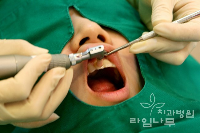 스케일링 건강보험 혜택 명동치과에서 7월부터 꼭 챙기세요 ^^ 관련 이미지 3