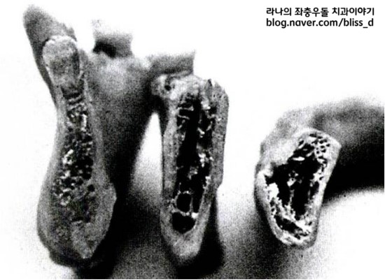임플란트 치료시 x-ray, ct 촬영이 필요한 이유 관련 이미지 2