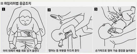 [명동치과 라임나무]응급조치 하임리히법, 꼭 알아두시고 사용하세요 관련 이미지 2