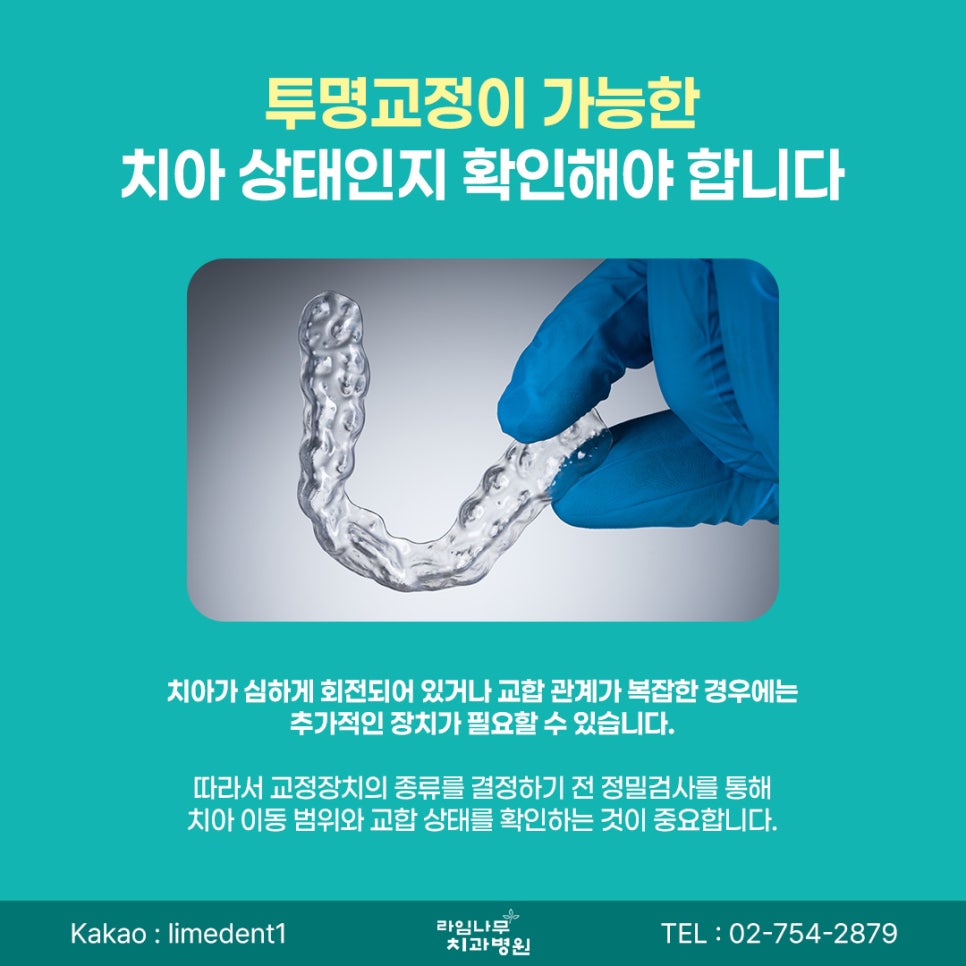 명동 투명교정 성인 투명교정, 시작 전 알아두면 좋은 체크사항 관련 이미지 6