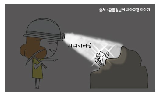 한 눈에 보는 치아교정 - 치아교정 장치의 종류 관련 이미지 4