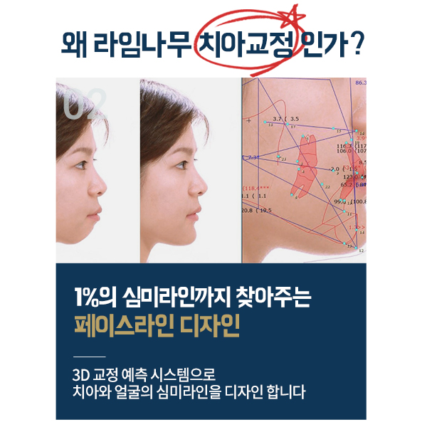 부담없이 치아교정기간을 소화하려면? 관련 이미지 7