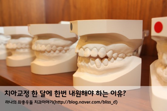 치아교정 한 달에 한번 내원해야 하는 이유? 관련 이미지 2