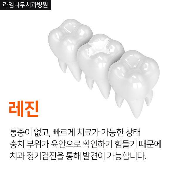보철치료종류(레진,인레인,크라운) 유지관리방법 관련 이미지 2