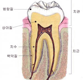 충치의 원인과 치료방법 관련 이미지 2