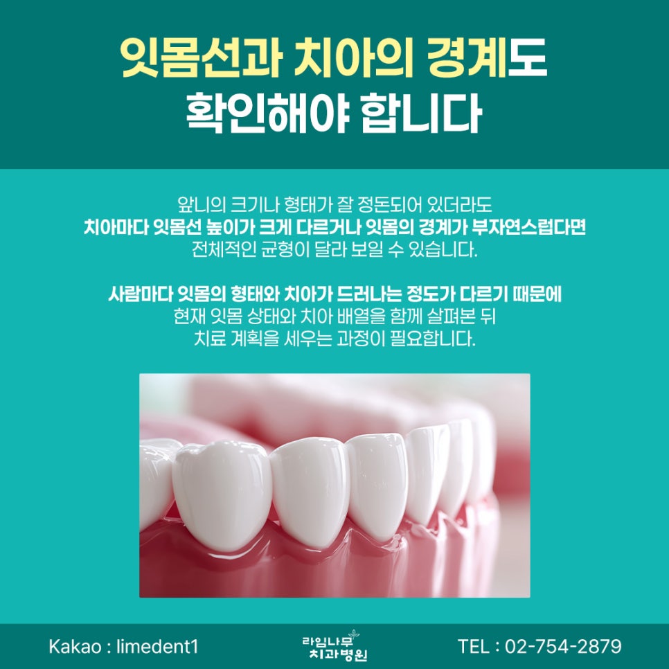 명동 라미네이트 전 꼭 확인해야 할 자연스러운 치아 디자인 기준 관련 이미지 6
