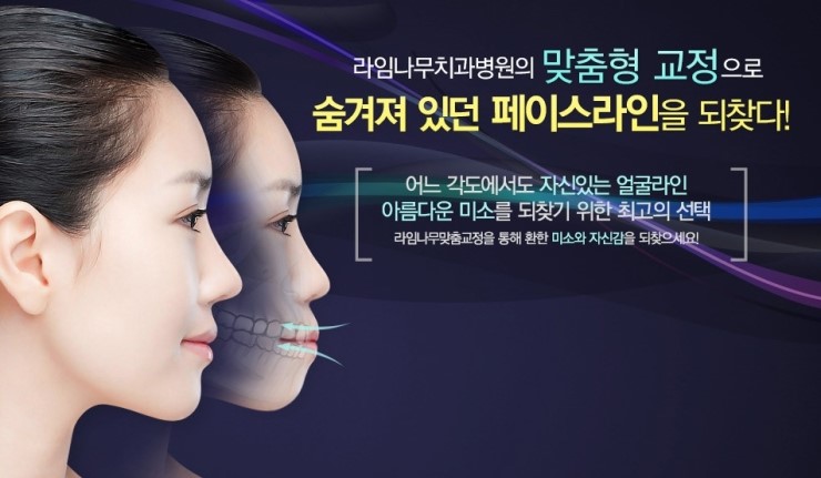 돌출앞니부분교정 토끼치아 탈출하자 관련 이미지 2