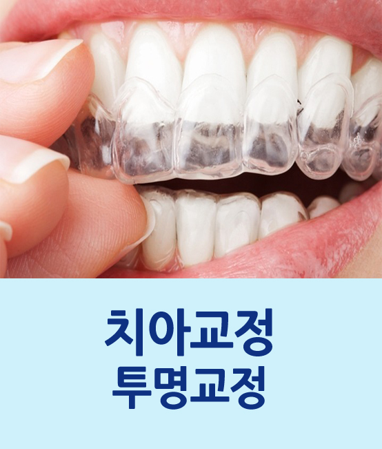 투명교정 진행시 고려해야할 점은? 관련 이미지 1