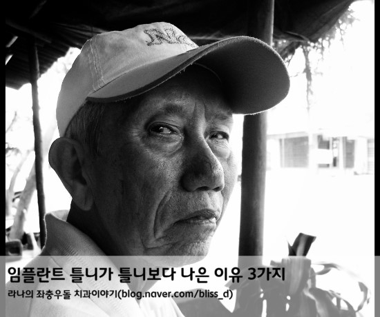 임플란트 틀니가 틀니보다 나은 이유 3가지 관련 이미지 1
