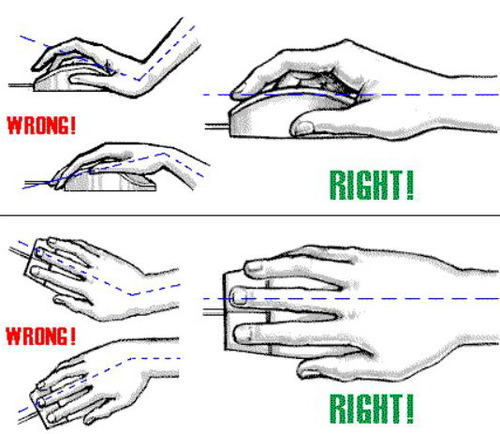 [명동치과 라임나무]손목터널증후군 초기증상, 손목 스트레칭 필수적입니다 관련 이미지 4