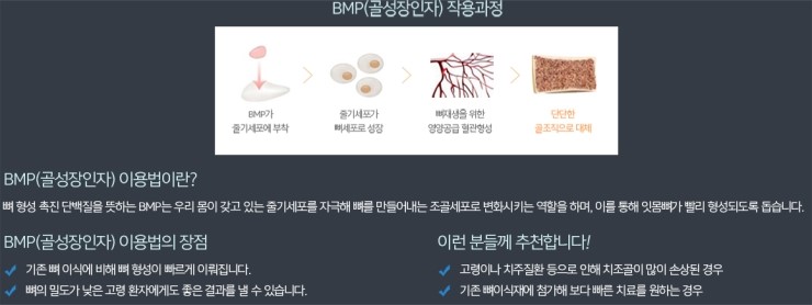 라임나무치과의 임플란트 솔루션을 소개합니다. 관련 이미지 7