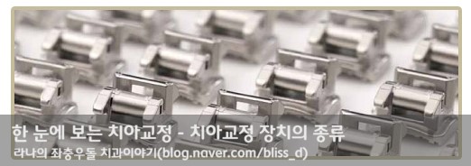 한 눈에 보는 치아교정 - 치아교정 장치의 종류 관련 이미지 2