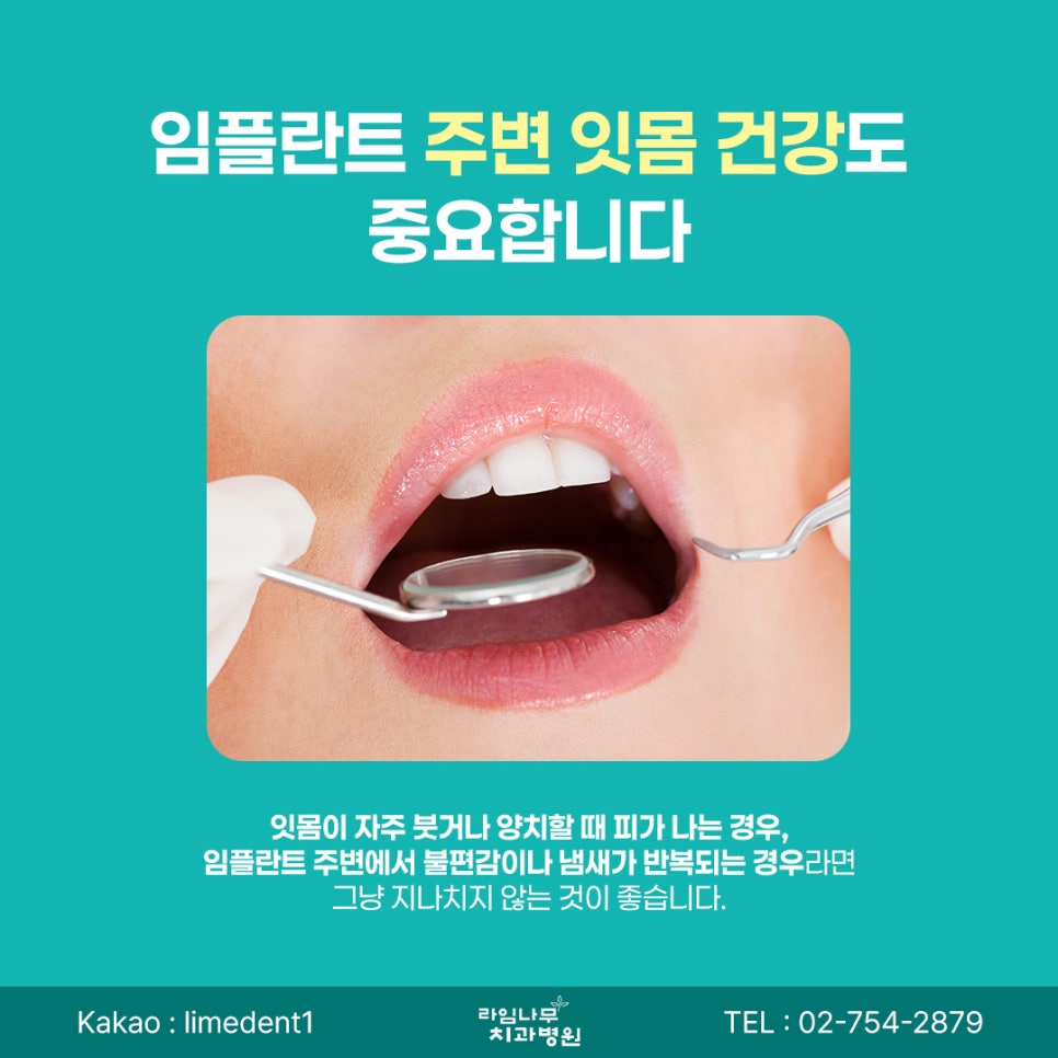 명동 임플란트 임플란트 수명, 오래 사용하려면 어떤 관리가 필요할까요? 관련 이미지 5