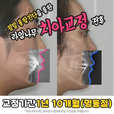 (명동치과 라임나무치과병원) 설날 맞이 선물증정식 했어용 &hearts; 관련 이미지 9