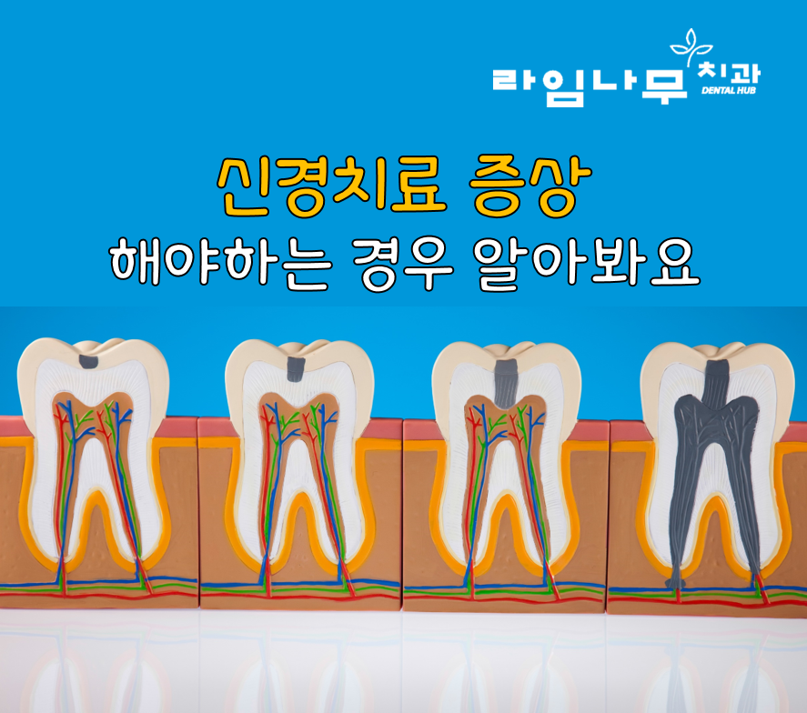 신경치료 해야되는 경우? 명동역치과와 증상 알아봐요 관련 이미지 1