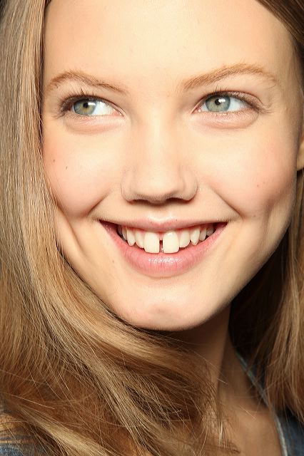 부정교합이란 무엇이며, 어떻게 치료할 수 있을까요 관련 이미지 4