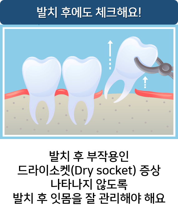 사랑니실밥 언제푸나요? 풀렸을때? 명동치과 라임나무 관련 이미지 6