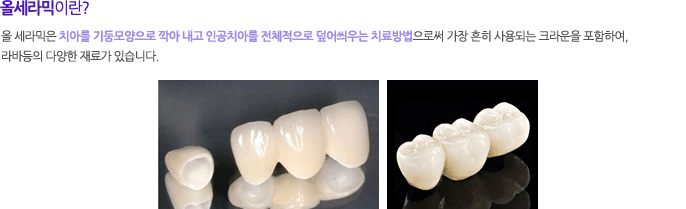 승무원들에게 라미네이트를 추천하는 이유? 관련 이미지 9