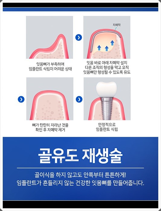 라임나무치과 오스템임플란트 비용이 궁금하셨다고요? 관련 이미지 10