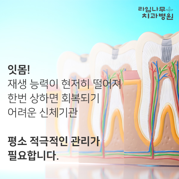 피곤하면 붓는 잇몸질환의 원인과 해결방법 관련 이미지 5